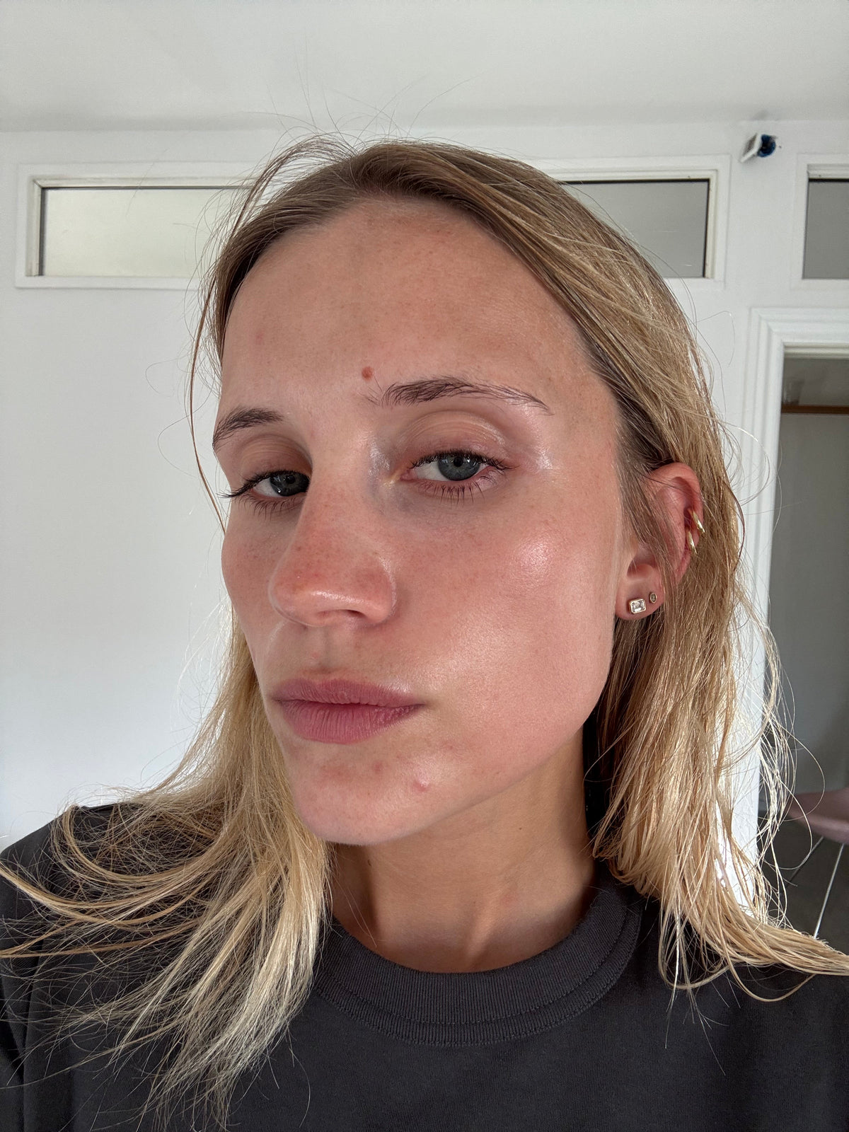 Sensitive skin: what to avoid and why